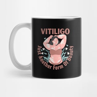 Vitiligo Just Another Form Of Beauty Female Model Mug